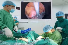 Đính lưới nhân tạo hiệu quả điều trị sa sinh dục tới 30 năm