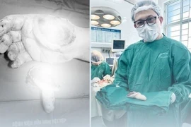 Nối thành công ngón tay đứt rời cho chiến sĩ công an