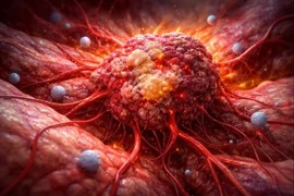 Dấu hiệu cảnh báo ung thư không nên bỏ qua