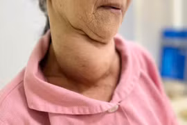 Bác sĩ thăm khám cho bệnh nhân sau phẫu thuật