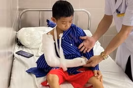 Nghỉ hè 1 tháng 50 trẻ nhập viện do tai nạn thương tích 
