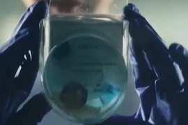 Thiết bị đổi màu dưới bồn cầu giúp phát hiện sớm bệnh thận