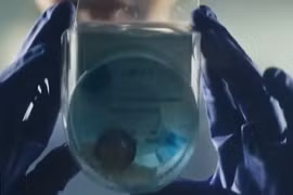 Thiết bị đổi màu dưới bồn cầu giúp phát hiện sớm bệnh thận