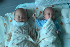 Cứu song thai từ trong bụng mẹ và cuộc chiến giành sự sống sinh non