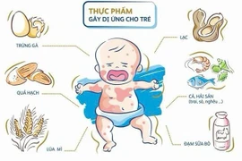 Hai trẻ dị ứng, sốc phản vệ nguy kịch do ăn trứng gà và tôm