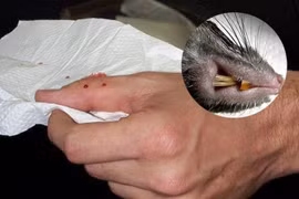 Nguy cơ mắc nhiều bệnh nguy hiểm từ vết cắn của chuột