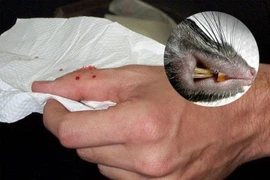 Nguy cơ mắc nhiều bệnh nguy hiểm từ vết cắn của chuột