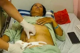 Tự uống thuốc đau bụng, người đàn ông vỡ ruột thừa nguy kịch