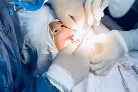 Hộ kinh doanh Nha khoa Việt Quốc bị phạt 33 triệu, đình chỉ hoạt động 3 tháng