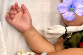Cứu bé gái hơn 2 tuổi uống nhầm thuốc diệt nấm 