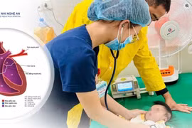 Trẻ 4 tháng ho đờm tưởng cảm lạnh không ngờ tim bẩm sinh phức tạp