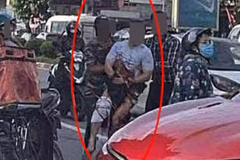 Tiktoker có tiếng ở Thái Nguyên bị chém đứt bàn tay