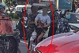 Tiktoker có tiếng ở Thái Nguyên bị chém đứt bàn tay
