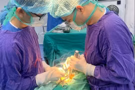 Loãng xương xẹp đốt sống gây chèn ép tủy, liệt chi