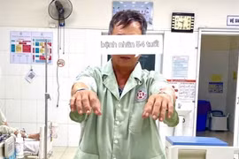 Tiêu sợi huyết giờ vàng cứu bệnh nhân đột quỵ trong lúc ăn cơm