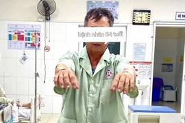 Tiêu sợi huyết giờ vàng cứu bệnh nhân đột quỵ trong lúc ăn cơm