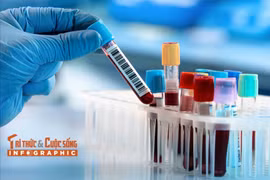 [INFOGRAPHIC] Những xét nghiệm cần thực hiện định kỳ