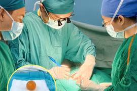 Nhiều trẻ nguy kịch vì nuốt hạt nở đồ chơi