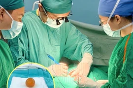 Nhiều trẻ nguy kịch vì nuốt hạt nở đồ chơi