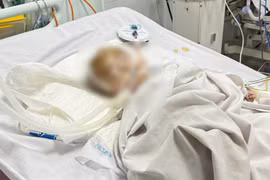 Điều tra vụ bé trai xuất huyết não tại một điểm giữ trẻ