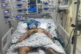 Hành trình 6 tháng cứu bé gái lóc da hiếm gặp do tai nạn giao thông