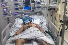 Hành trình 6 tháng cứu bé gái lóc da hiếm gặp do tai nạn giao thông