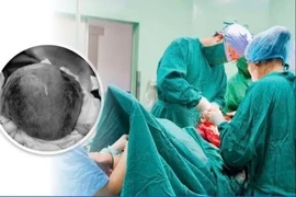 Cứu sống sản phụ rau bong non nguy kịch