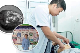 Cắt u lách khổng lồ, bảo tồn miễn dịch cho bệnh nhi 14 tuổi