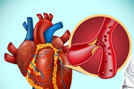 Cảnh báo nhiều bệnh ít triệu chứng nhưng nguy hiểm cao