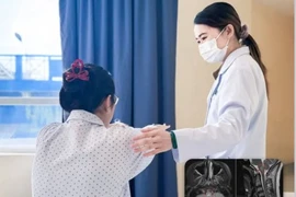 Chóng mặt, yếu tay chân, thanh niên 17 tuổi bị viêm tủy thị thần kinh