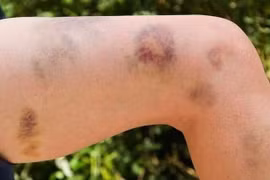 Đe dọa tính mạng vì dùng thuốc không rõ nguồn gốc