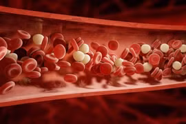 Giải pháp tự nhiên giúp làm sạch mạch máu, phòng bệnh tim