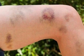 Đe dọa tính mạng vì dùng thuốc không rõ nguồn gốc