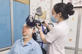 Kích thích não không xâm lấn, phục hồi đột quỵ