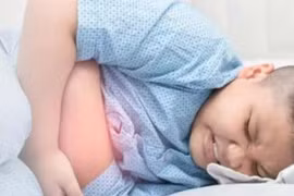 3 trẻ bị viêm ruột thừa vỡ, nguy hiểm tính mạng do tự điều trị tại nhà