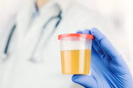 Nguy hiểm từ việc dùng nước tiểu chữa bệnh, bác sĩ cảnh báo nóng