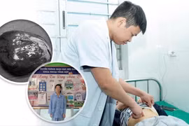 Phẫu thuật thành công ca u nang lách khổng lồ cho bệnh nhi ở Nghệ An