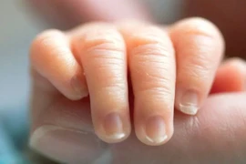 Bé sơ sinh bị suy hô hấp nặng hồi phục kỳ diệu 