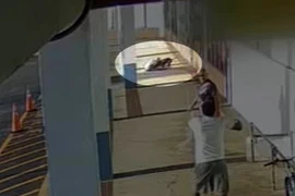 Chó cưng bị tấn công, người phụ nữ cắn lại con chó Pitbull hung dữ 