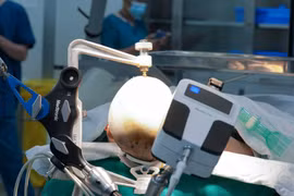 Vinmec Central Park mở lối đi mới trong điều trị động kinh bằng Robot 