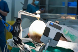 Vinmec Central Park mở lối đi mới trong điều trị động kinh bằng Robot 