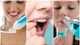 Cách chăm sóc răng miệng sau truyền hóa chất ung thư