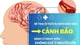 Đang khỏe mạnh, bé trai 13 tuổi đột ngột nhồi máu não