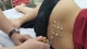Nhiều sản phụ bí tiểu sau sinh, cách gì khắc phục?