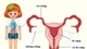 Chơi đùa té ngã, bé 12 tuổi tổn thương nghiêm trọng vùng kín