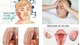 Lây quai bị từ con gái, người đàn ông ở Hà Tĩnh có nguy cơ vô sinh