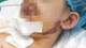 Nhiều trẻ nguy kịch vì tai nạn thương tích ngày hè