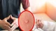 Bác sĩ mách cách phát hiện bệnh sùi mào gà 
