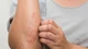 Lấy xong ổ giun lươn đã hết bệnh?