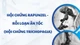 Bé trai 7 tuổi phải phẫu thuật tắc ruột vì thích ăn tóc